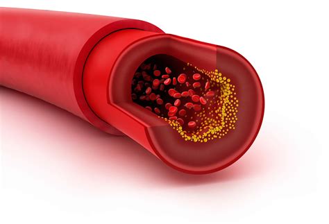 יואל קסלר .com Cannabis and Cardiovascular Disease